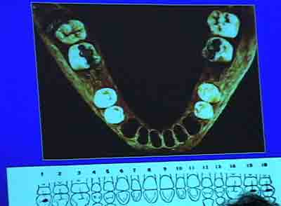 Click For Enlargement